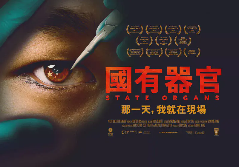 Featured image of post 轉貼：何謂“粉紅基”？